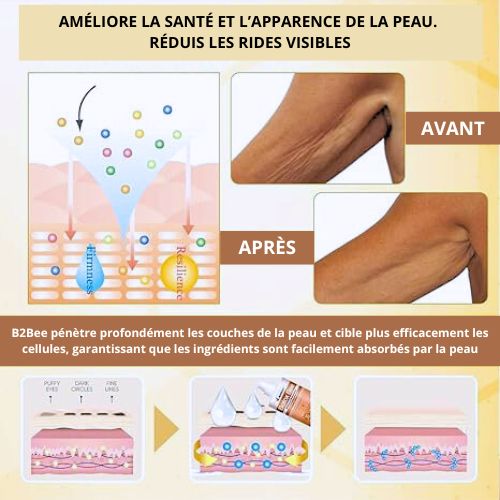 B2Bee Botox Bee