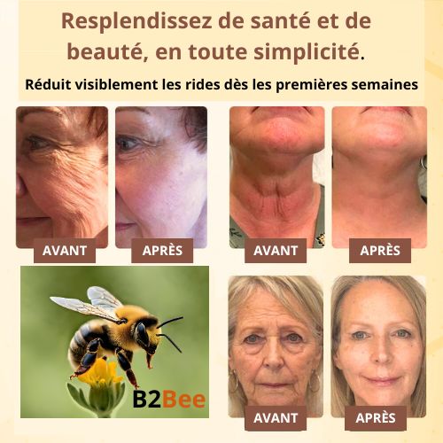 B2Bee Botox Bee