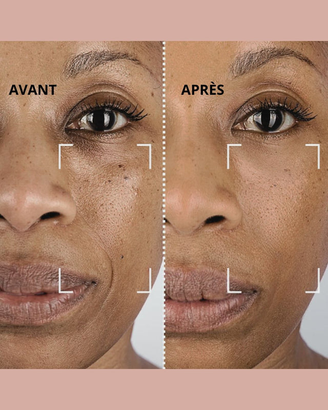 LUMIMasQ ... Un soin professionnel à domicile avec ce masque Led 7 couleurs